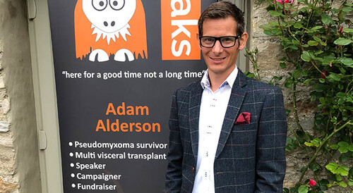Adam Alderson