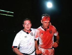 Terry Butcher