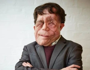 Adam Pearson